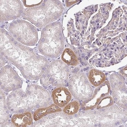 TMEM107 Antibody, Novus Biologicals 25 &mu;L, Unlabeled:Antibodies, Polyclonal
